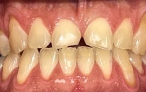 Before dental treatment