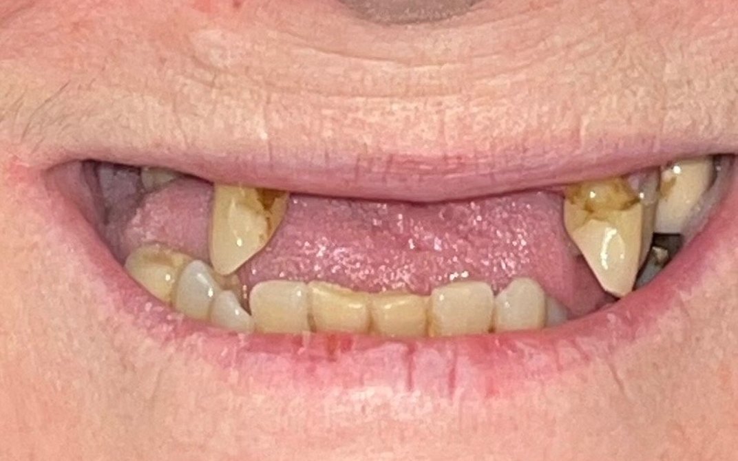 Before dental treatment