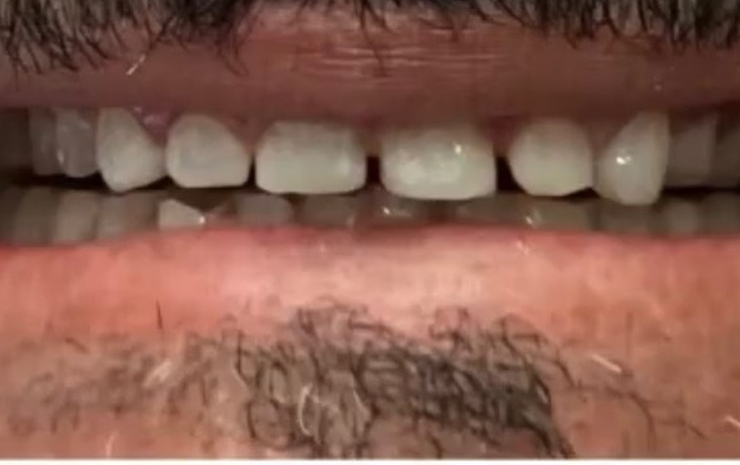 Before dental treatment