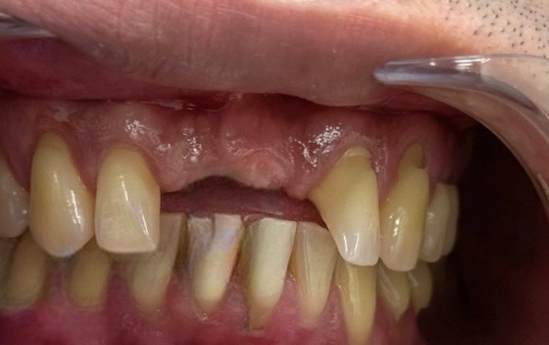 Antes del tratamiento dental