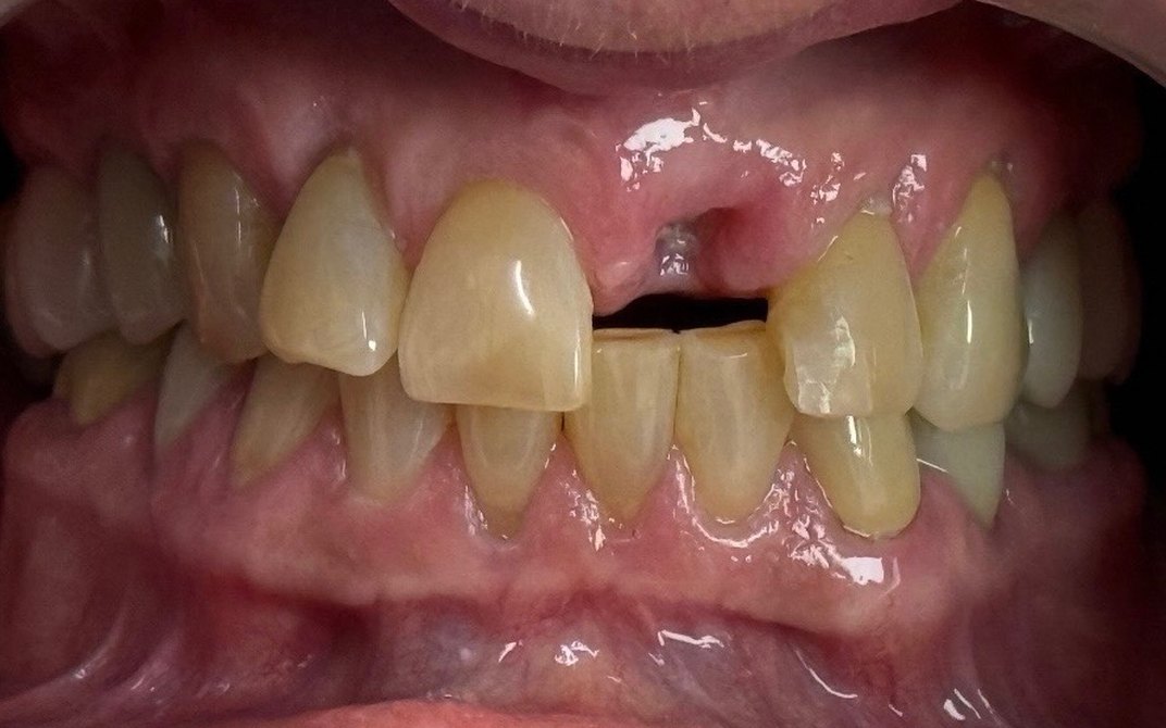 Antes del tratamiento dental