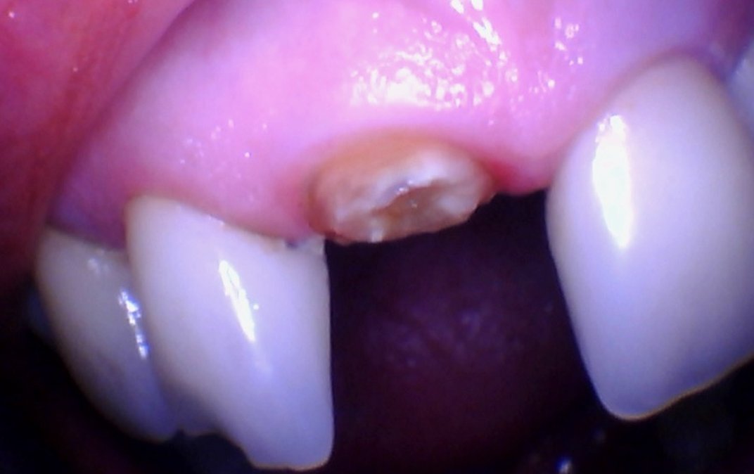 Antes del tratamiento dental
