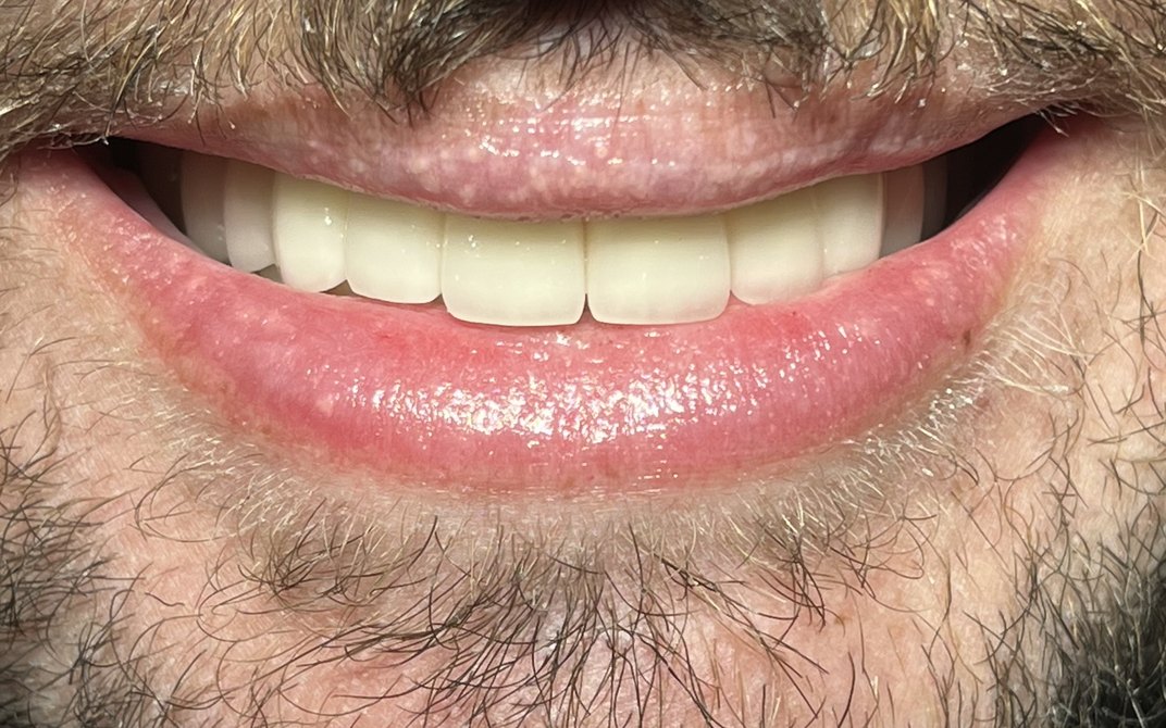 After dental treatment