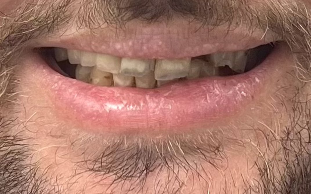Antes del tratamiento dental
