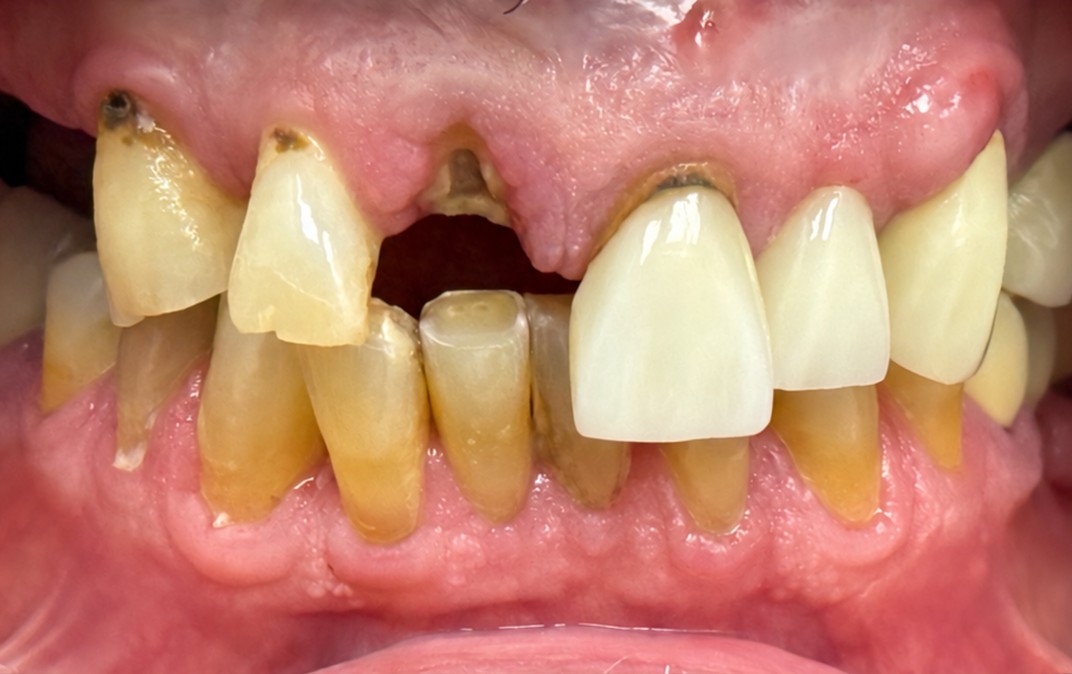 Before dental treatment