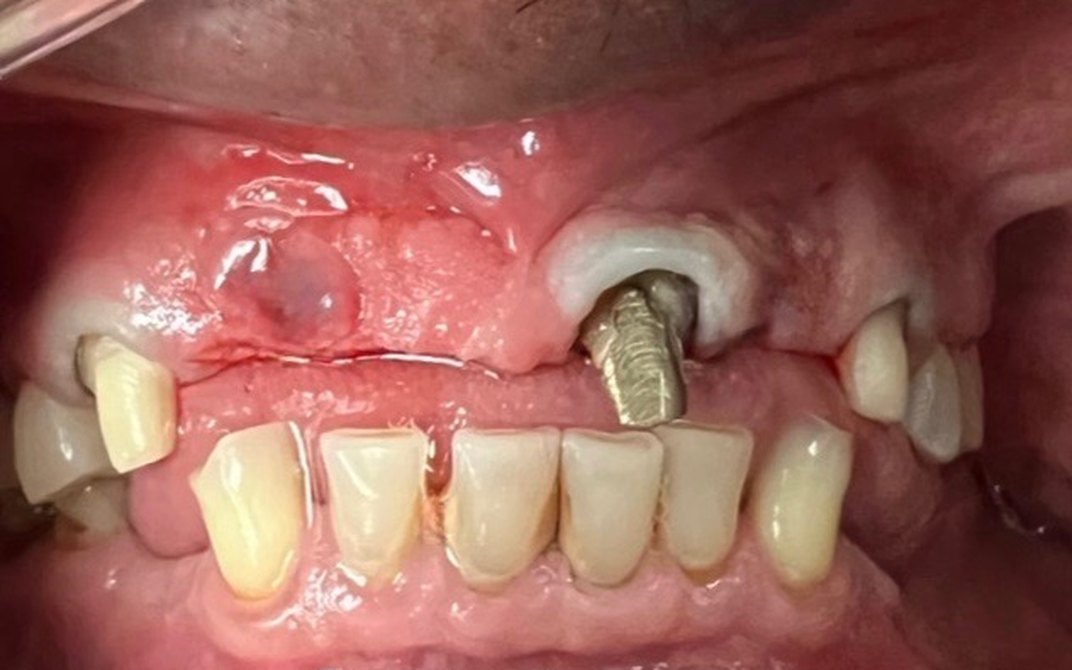 Before dental treatment