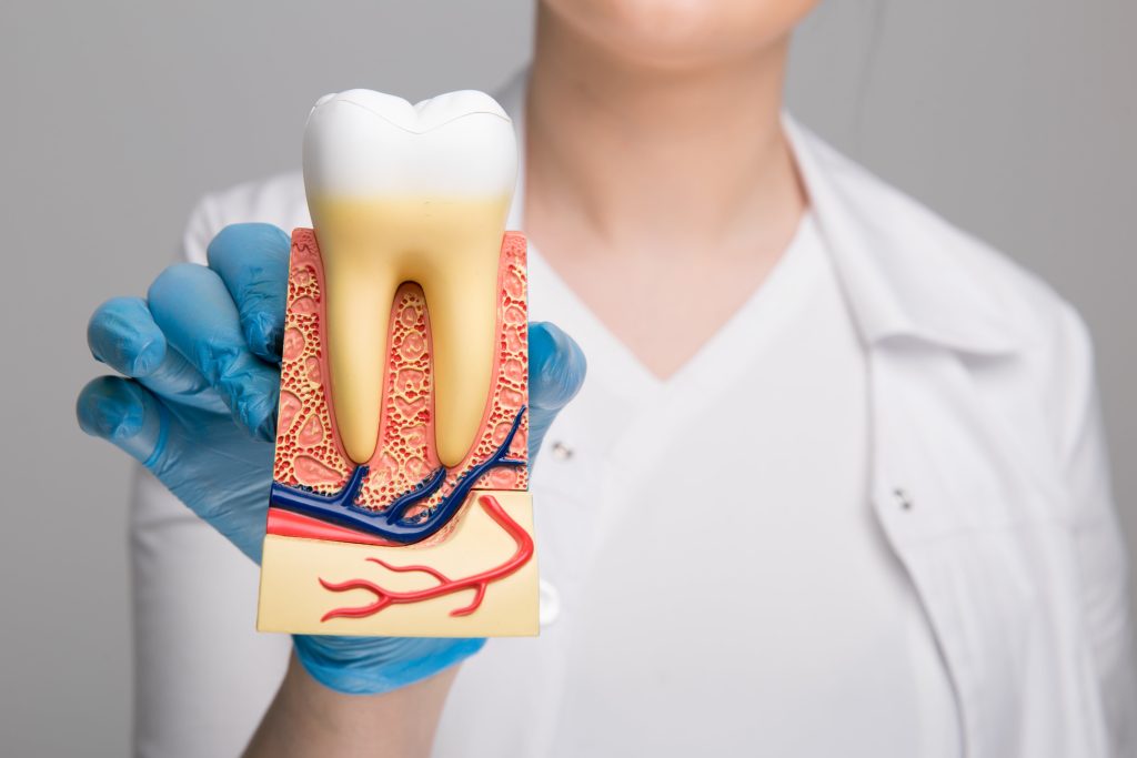Why Opt for a Root Canal