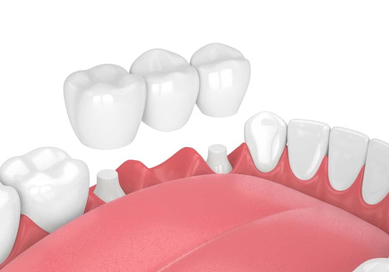 Seamless Smile Solutions